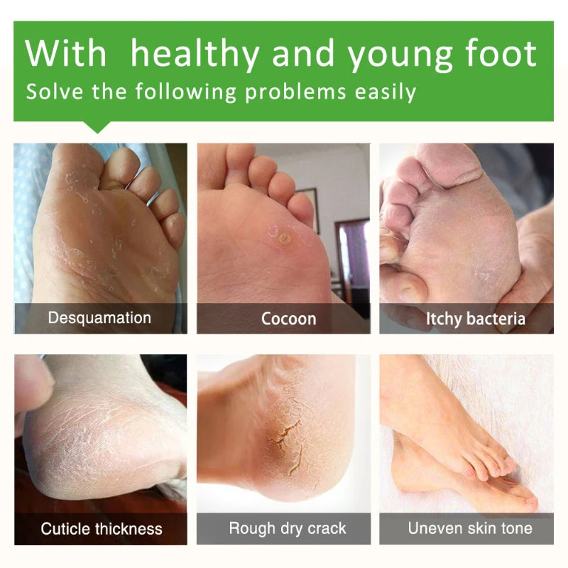 Exfoliating Foot Mask Socks